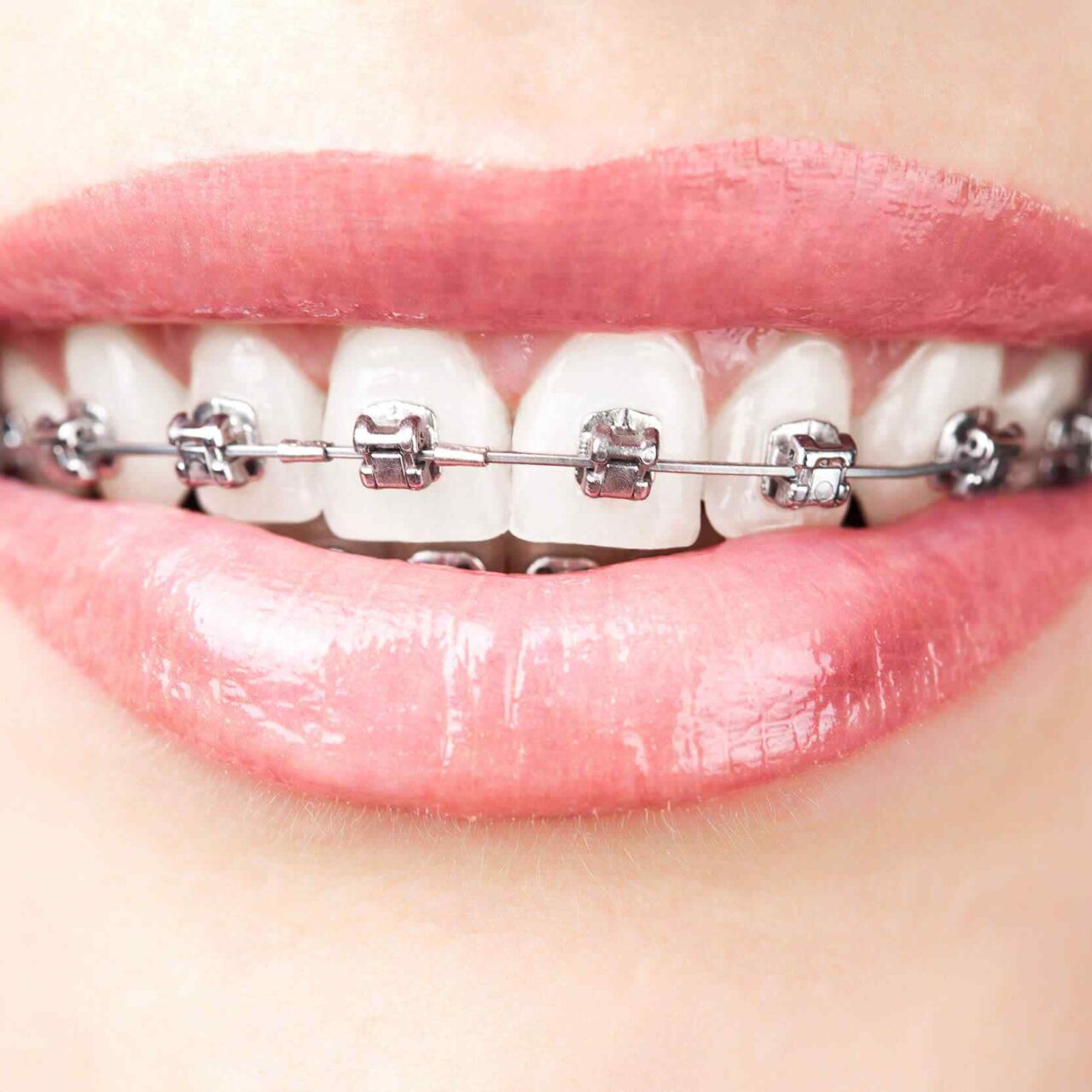 https://dentalistmed.com/wp-content/uploads/2020/01/post-03-1280x1280.jpg