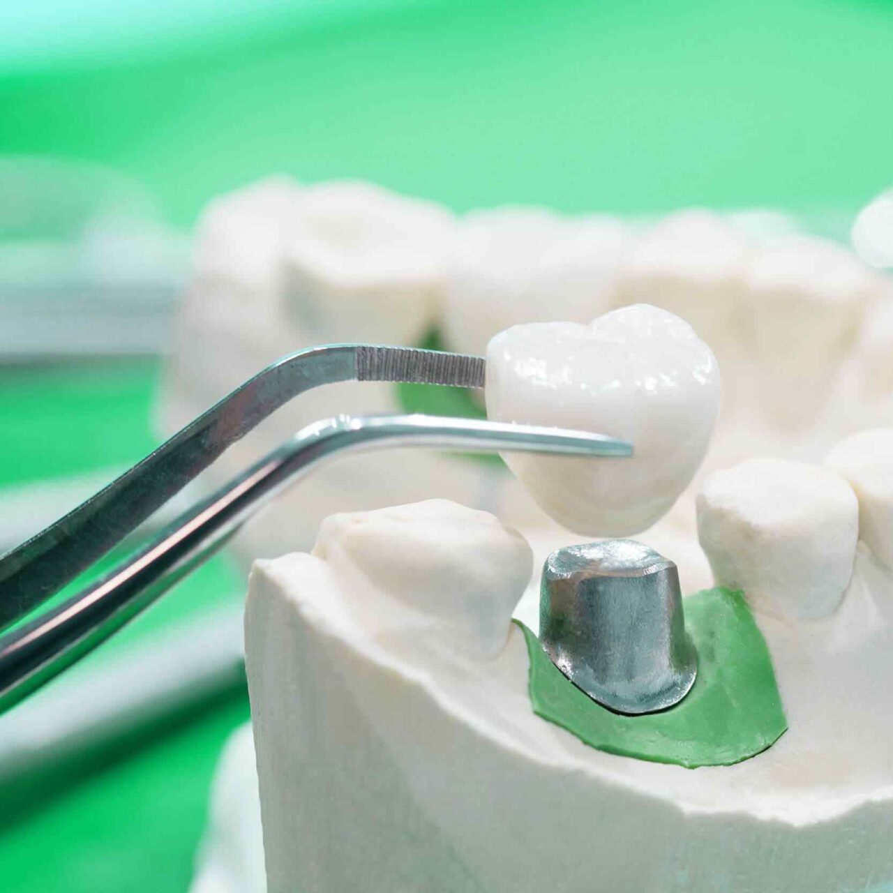 https://dentalistmed.com/wp-content/uploads/2020/01/post-28-1280x1280.jpg
