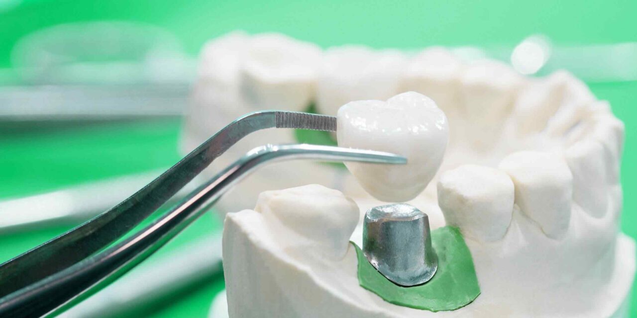 https://dentalistmed.com/wp-content/uploads/2020/01/post-28-1280x640.jpg